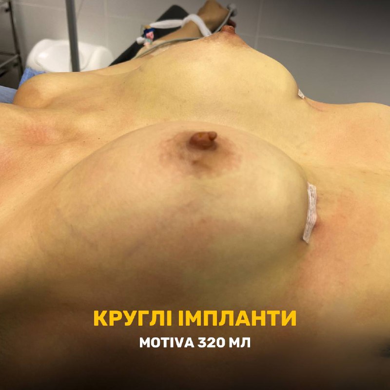 Результат